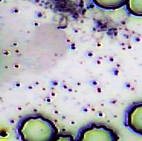 Pleomorphic Bacteria